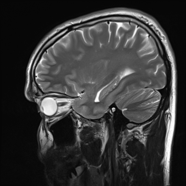 MRT-Aufnahme von einem Kopf, mrt rostock schillingallee